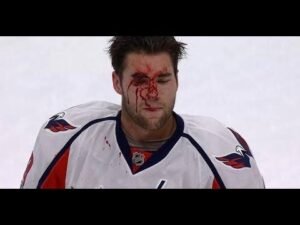 Tom Wilson: Injury| Fights| Vs Ryan reaves| Age| Bobblehead