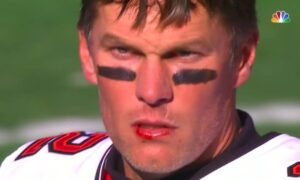 Tom Brady: Bloody lip| Unsportsmanlike| Retire today