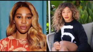 Serena Williams: New look| Plastic surgery| Face| Wedding