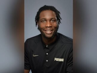 Caleb Swanigan: Before and after| Reddit| Natural causes