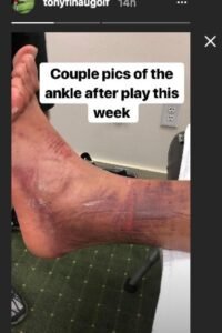 Tony Finau: Ranking| Swing| Ankle| Home| Children