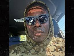 David Njoku: How did burn his face| What happened to| Fire