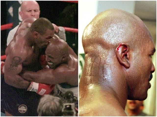 Mike Tyson: Whose ear did bite| Autographed glove| Is a rapist