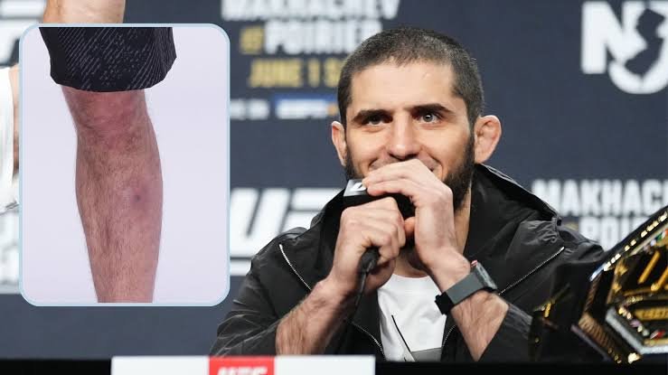 Islam Makhachev: Staph| Loss| Fights| UFC 302