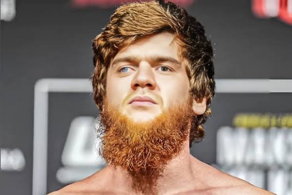 Shara Magomedov: Nose| Is blind in one eye| Eye Injury