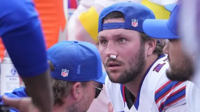Josh Allen: Nose injury| Nose| Injury today| Today| Broken nose