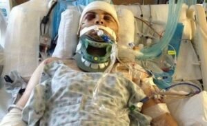 Michael Schumacher: Is still bedridden| After accident| Now photo