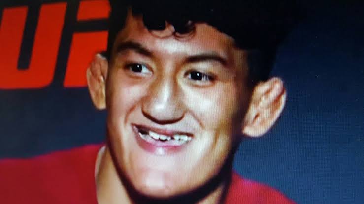 Raul Rosas Jr: Fight tonight| Have teeth| Does have teeth| Top teeth ...